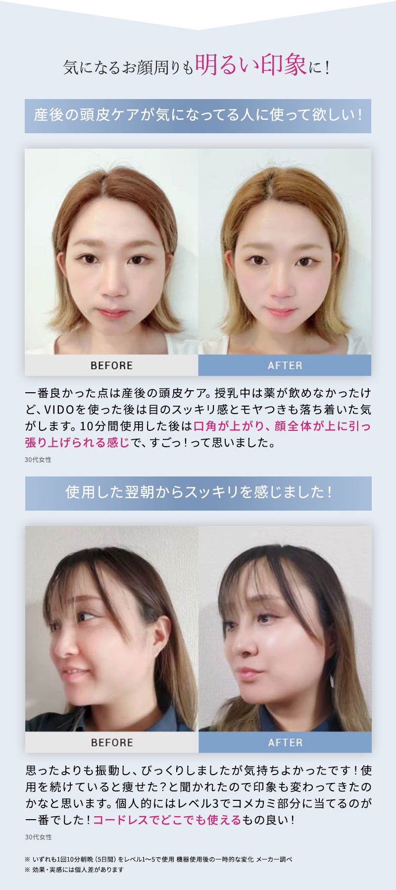 マイトレックス ヘッドマッサージャー ビドー