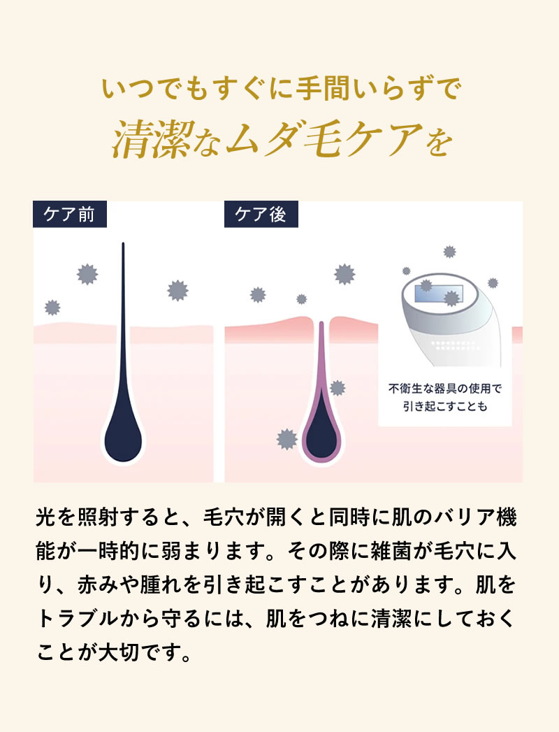 ステラボーテ IPL光美容器