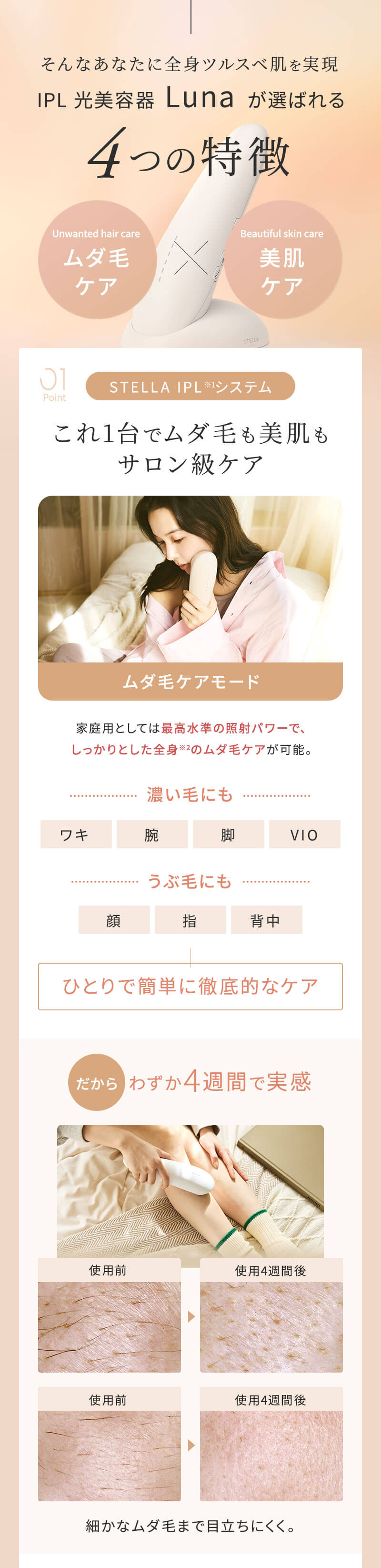 ステラボーテ  IPL 光美容器 Luna ルナ